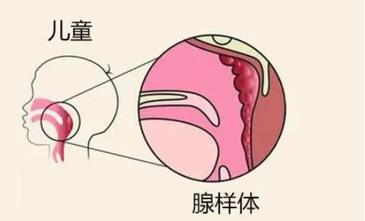杭州三代试管助孕：女性内膜和胚胎不同步成功率不高，厚度达标才能促好孕